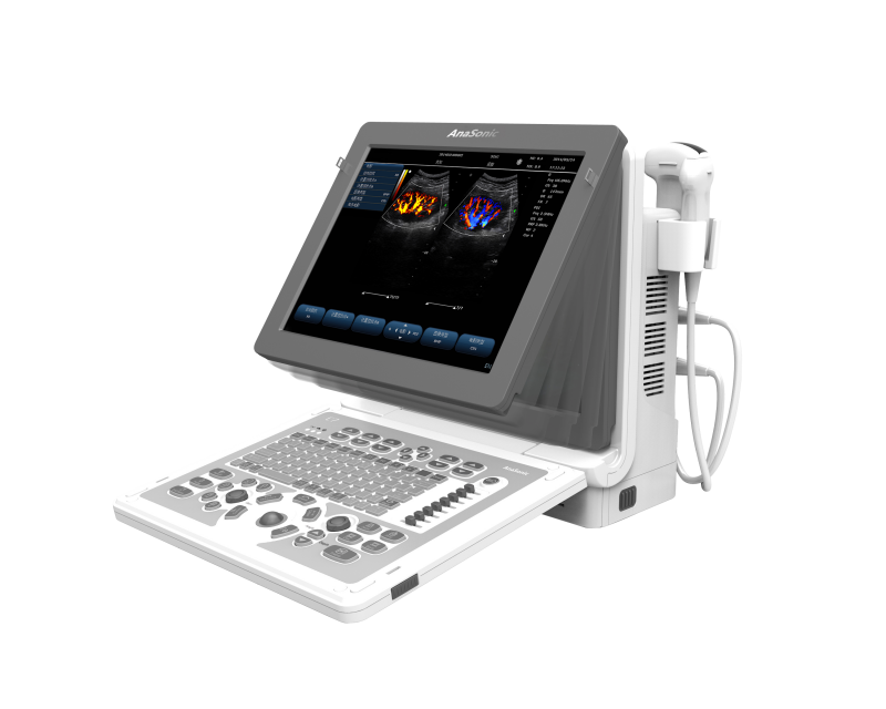 Echographe doppler portable ANASONIC C7 pour cardiologue